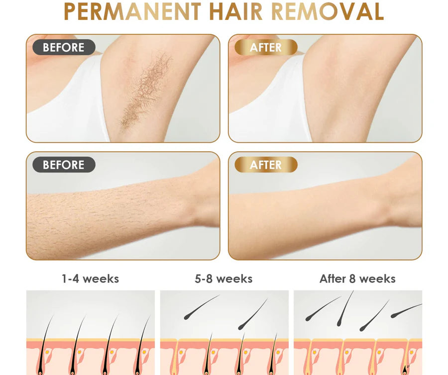 Multi Pro+ IPL HAIR REMOVAL